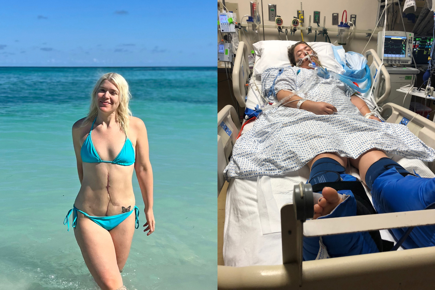 Images of woman post jetski accident