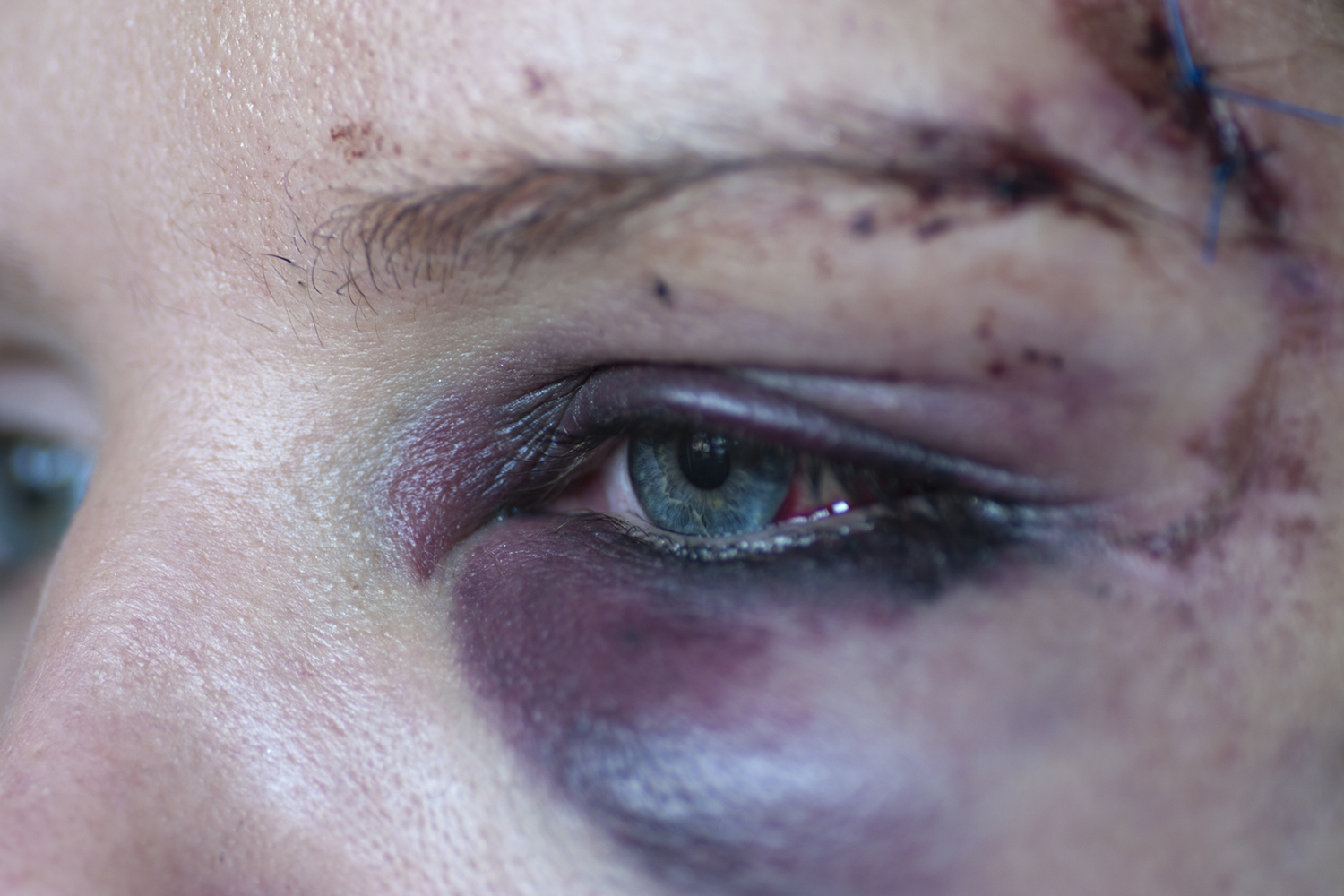 eye