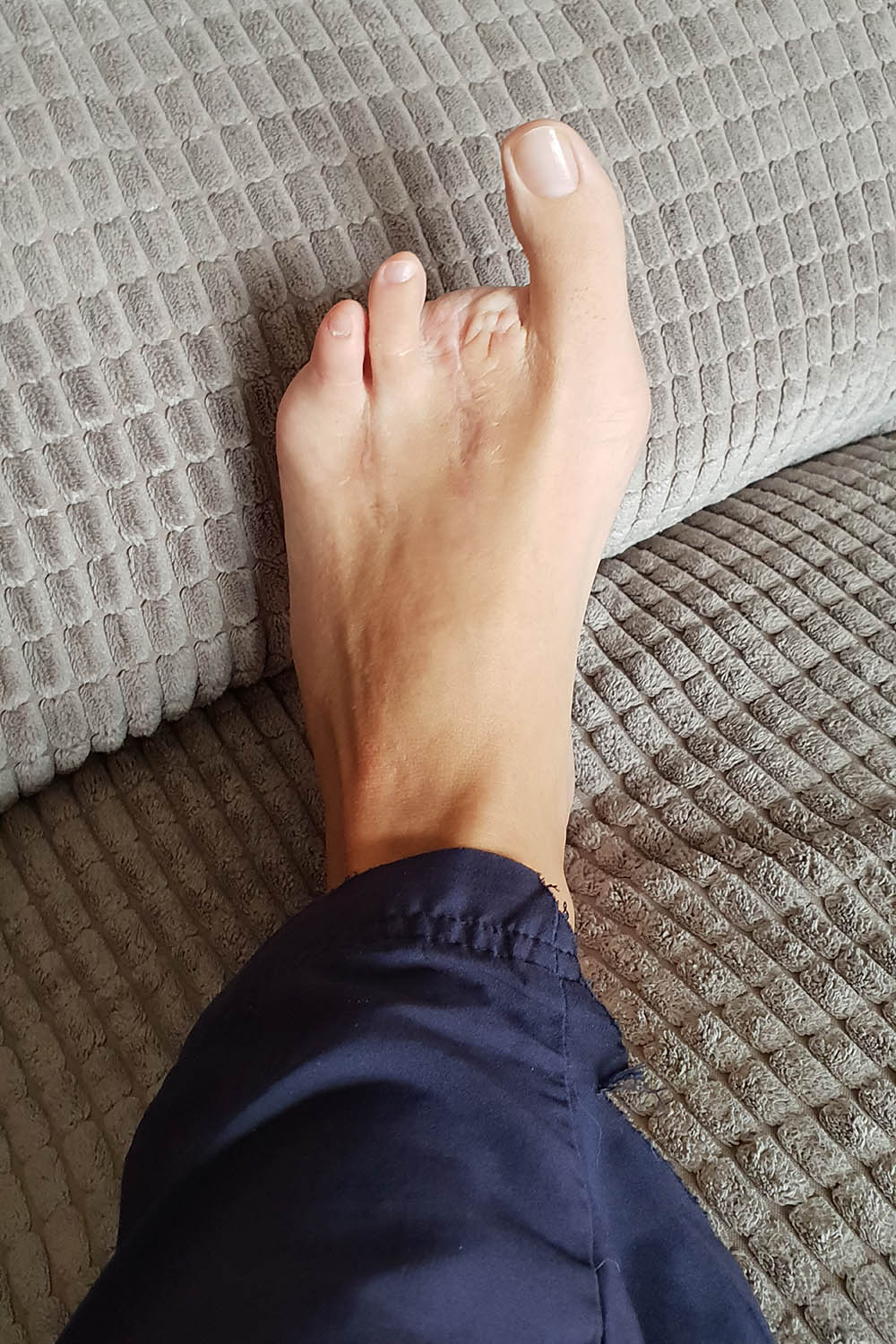 toe